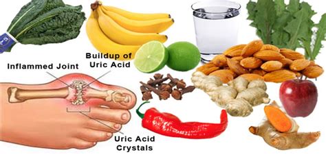 Foods high in uric acid chart - Drink 8 to 12 glasses of water daily (2-3 qts) to promote excretion of uric acid. If you have high blood pressure, heart disease, or take a ‘water pill’ or diuretic, talk with your doctor first. 6. Maintain ideal body weight. If overweight, a gradual weight reduction of 1-2 lbs. a week is suggested. Limit foods high in fat and sugar to aid ...